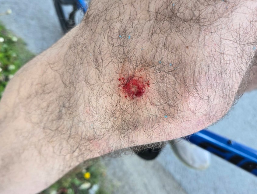 Atteint par une balle de paintball sur une piste cyclable de&nbsp;Québec
